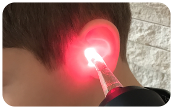 Fül gyógyítása safe laser és száloptika